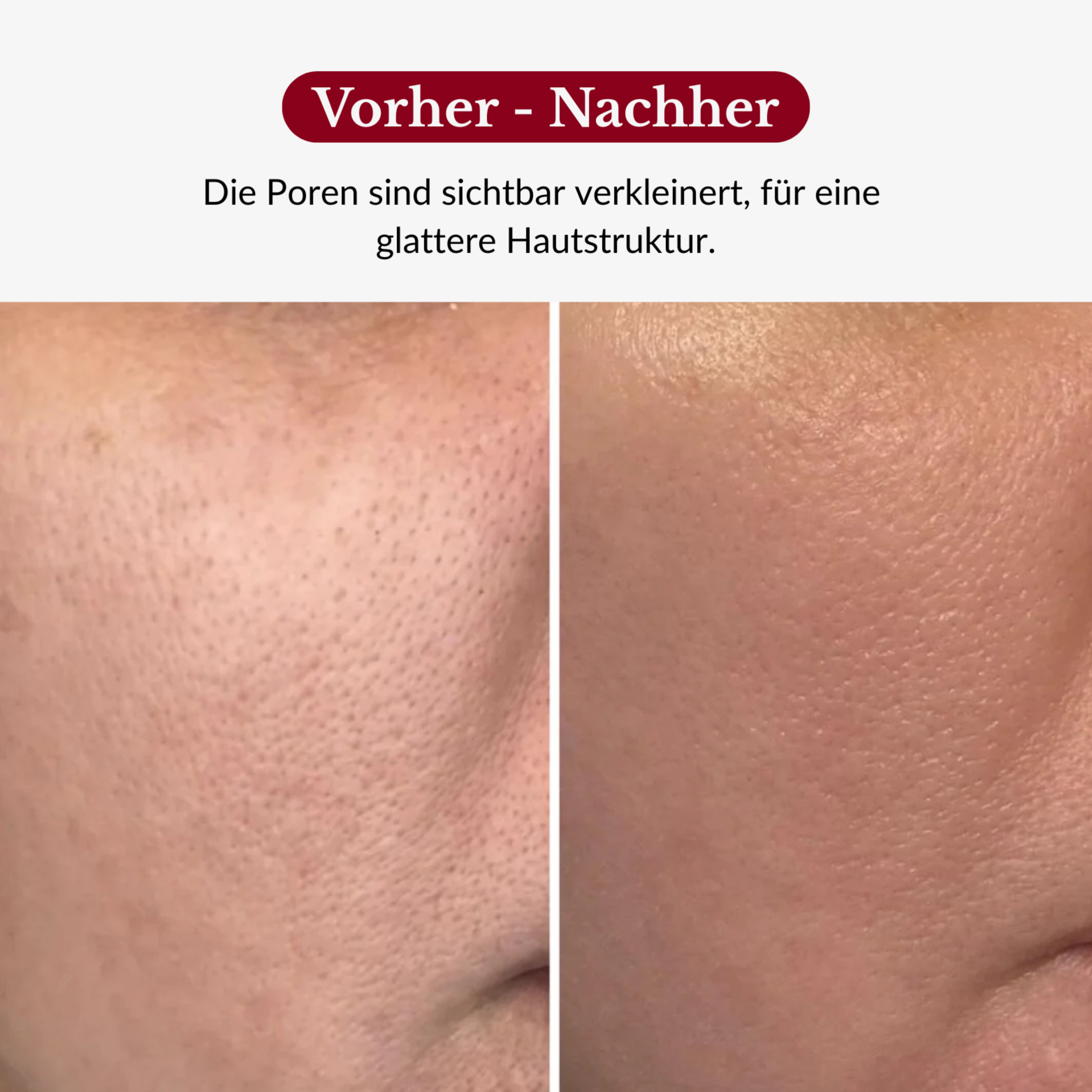 Rice Peeling Glow Serum