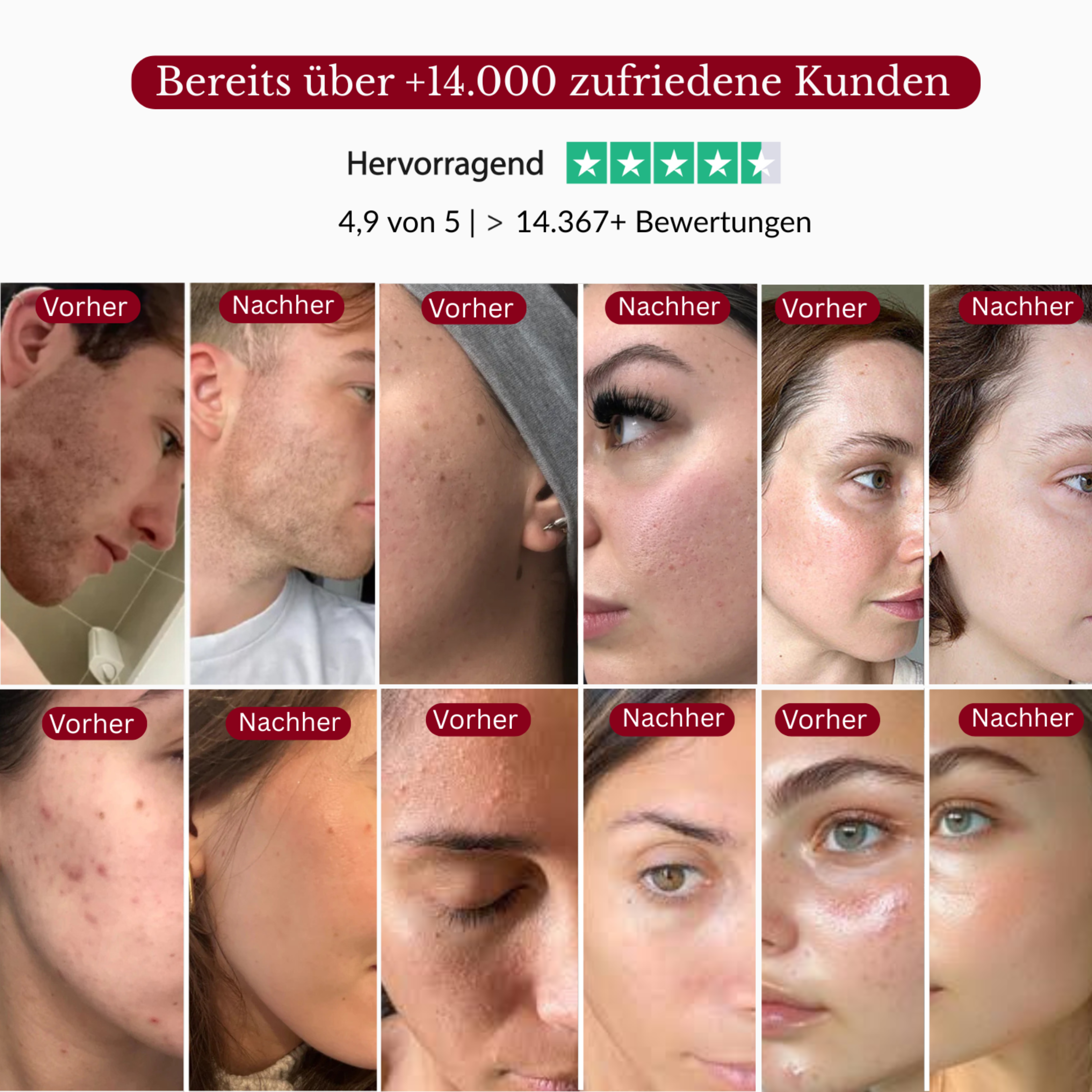 Rice Peeling Glow Serum