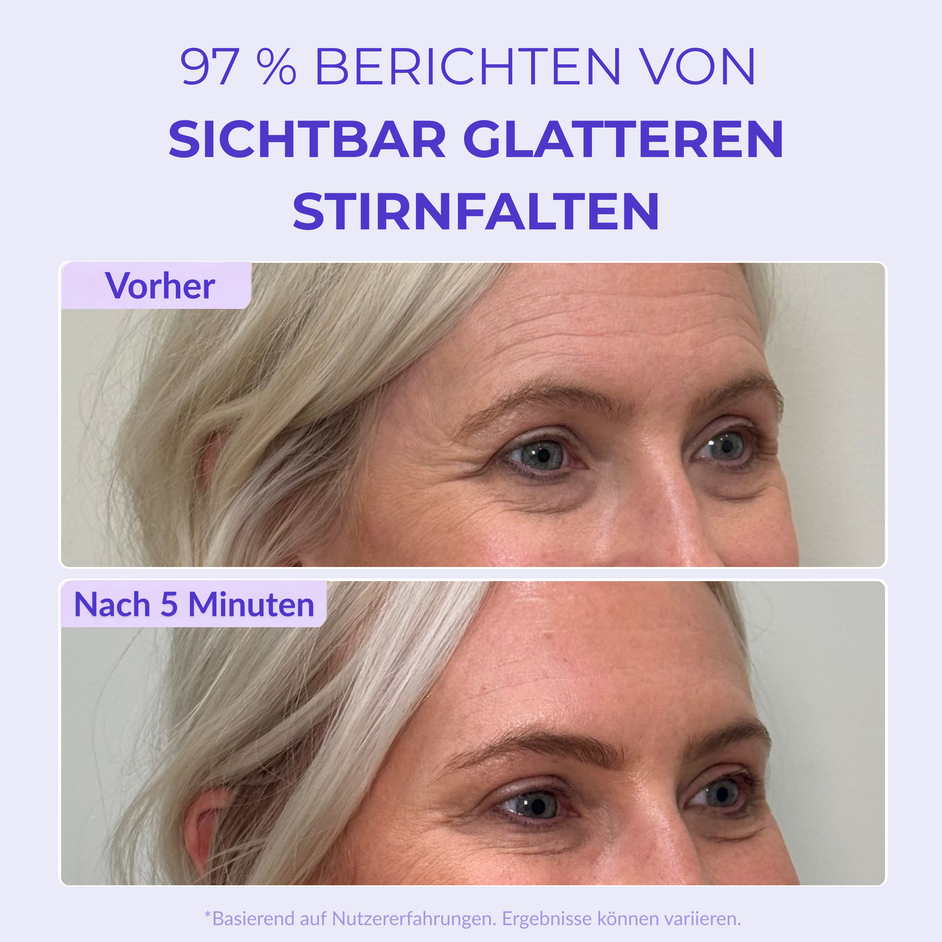 Instant Lift Eye Gel