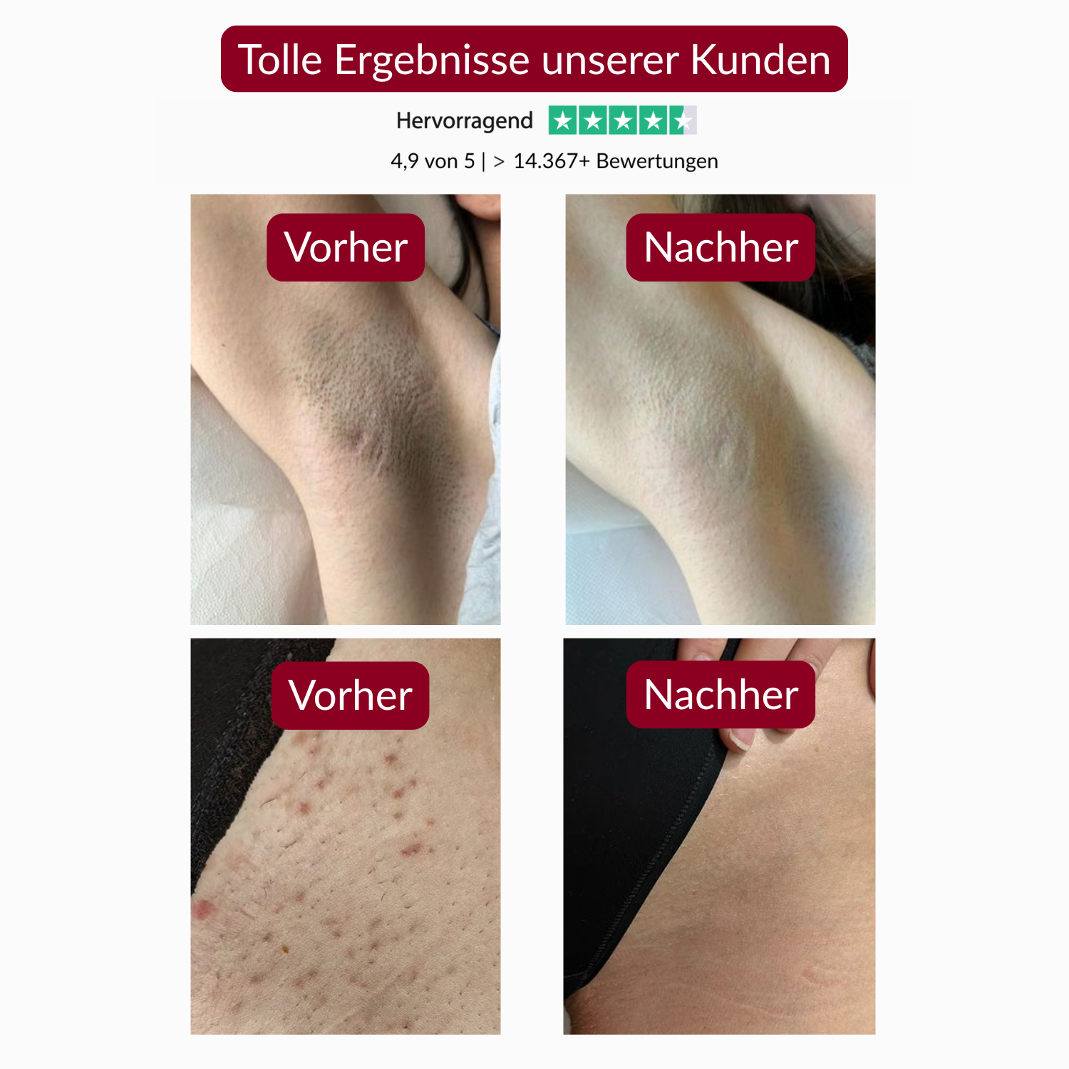 Body Peeling Spray