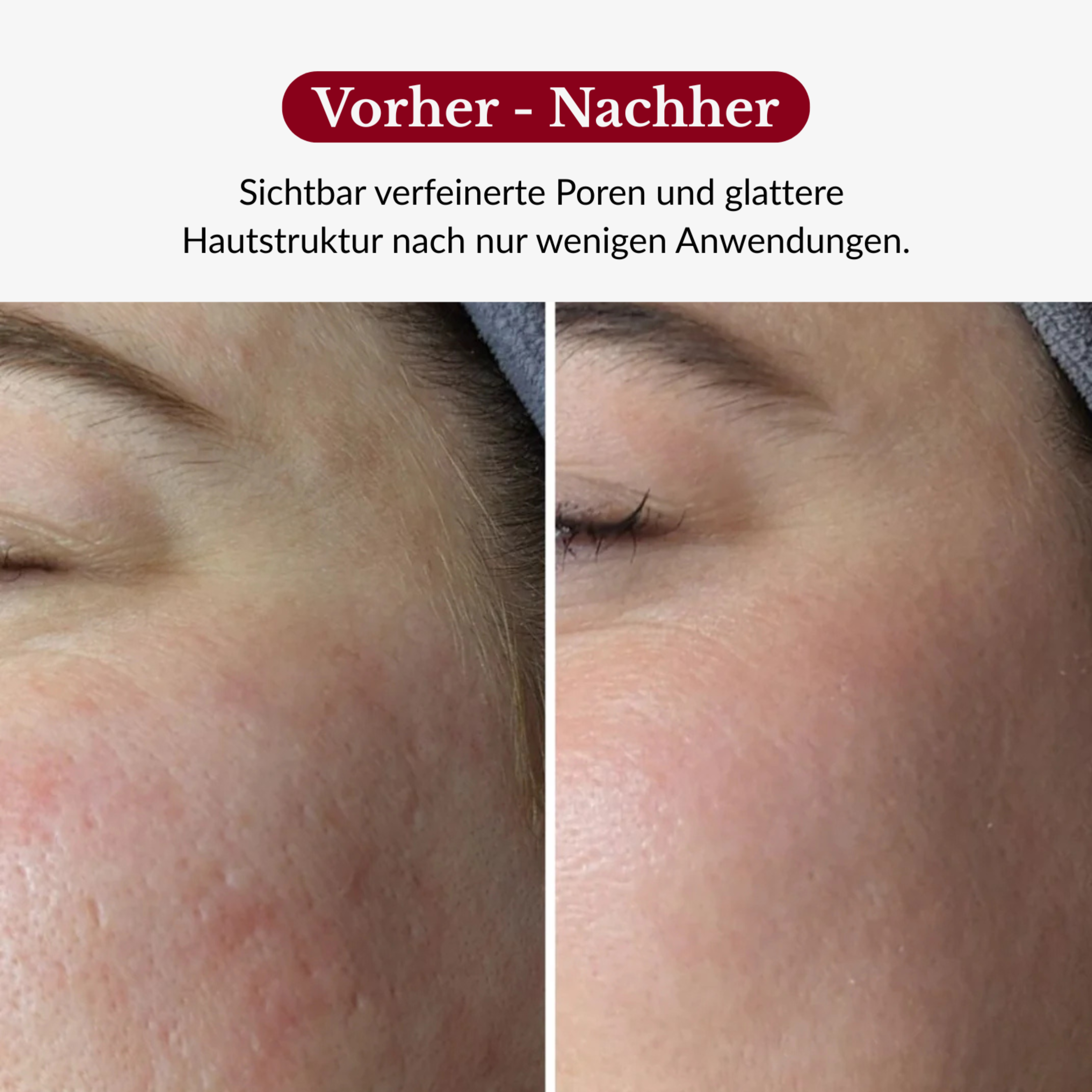 Rice Peeling Glow Serum