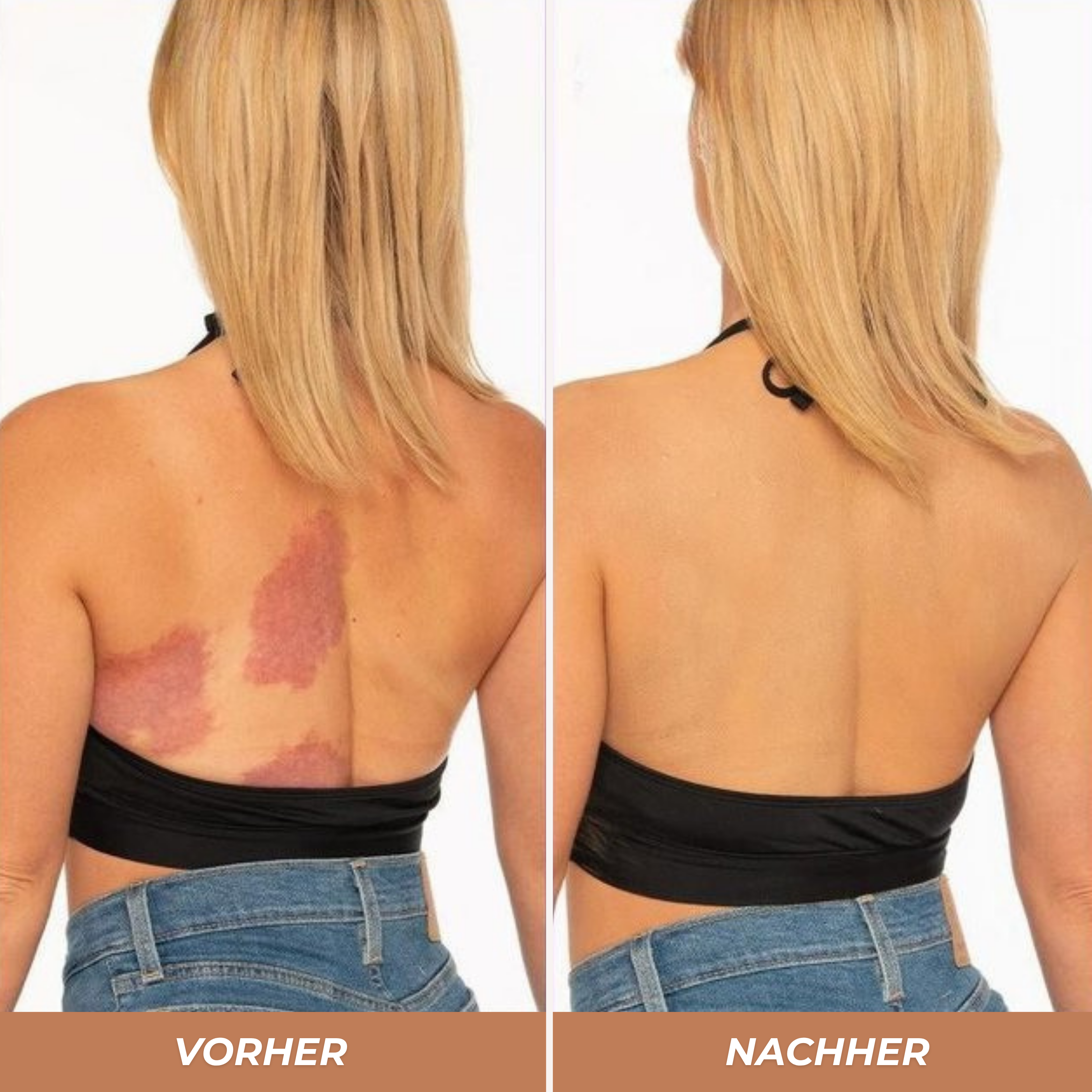 Body Coverage Perfector