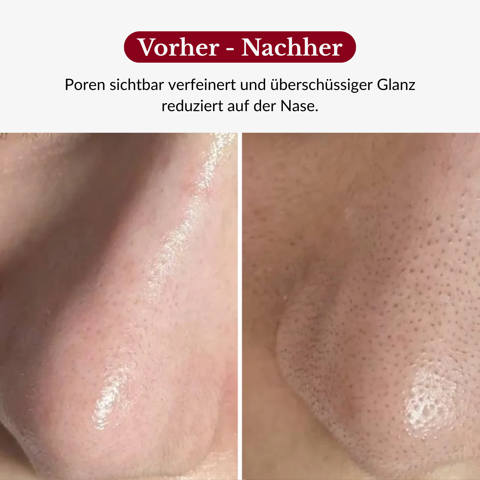 Rice Peeling Glow Serum