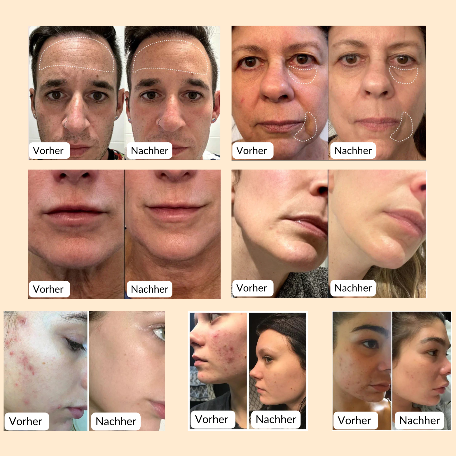 Der Schlüssel zu strahlender, makelloser Haut