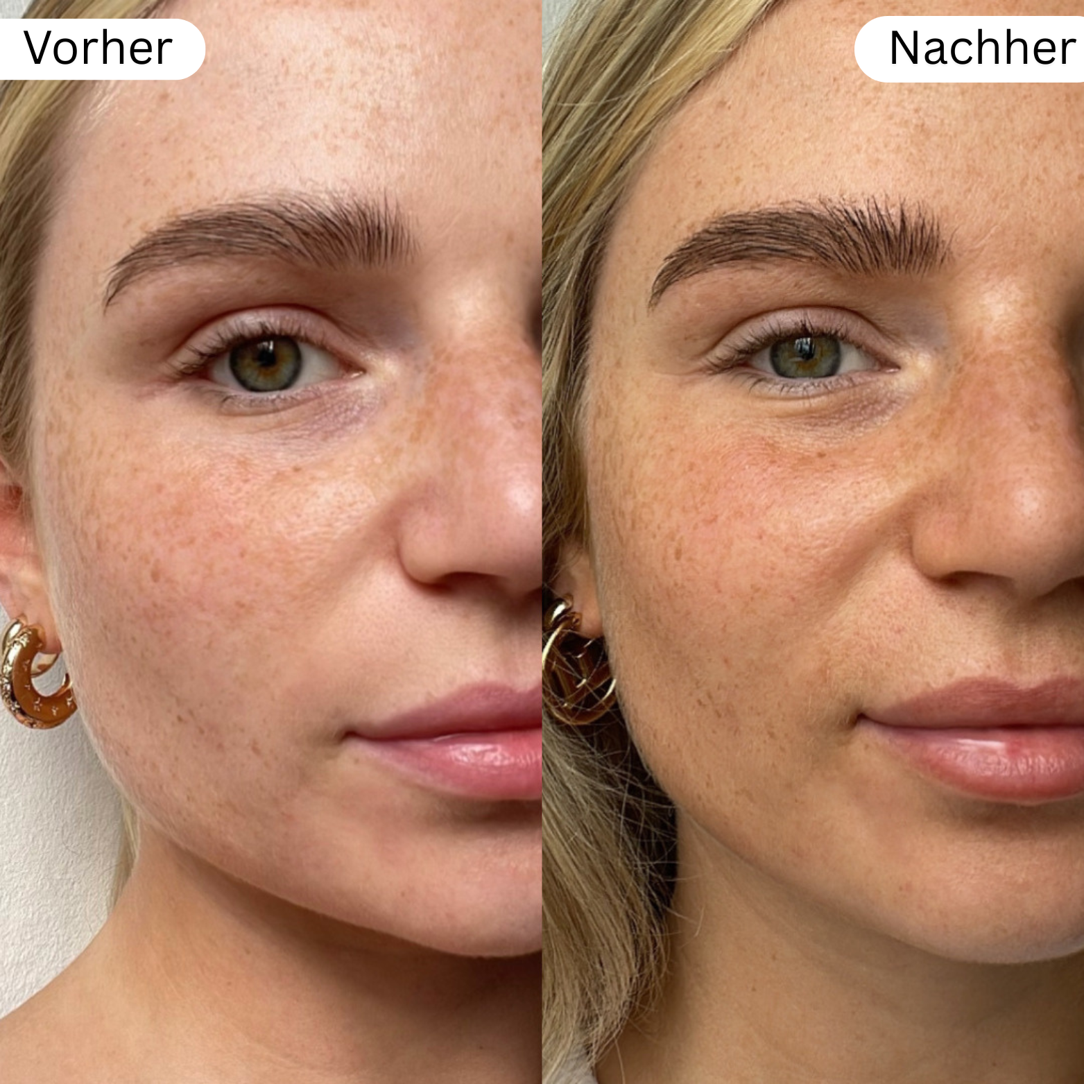 Brown Drops | Natürliche Bräunungstropfen für Gesicht & Körper